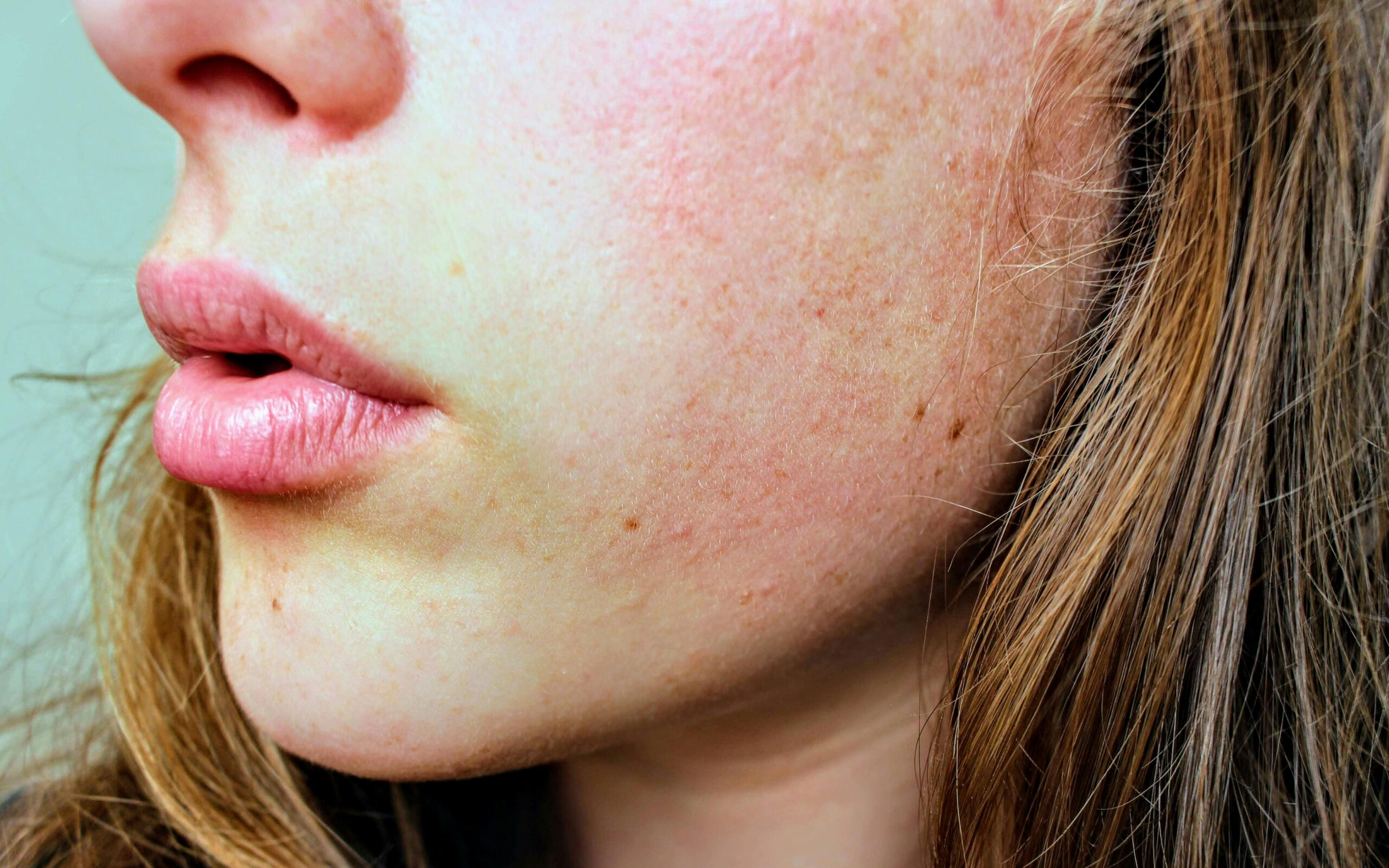 Close-up of a woman’s cheek showing natural skin texture and mild bumpy skin, used to illustrate uneven texture in dry climates and skincare concerns.
